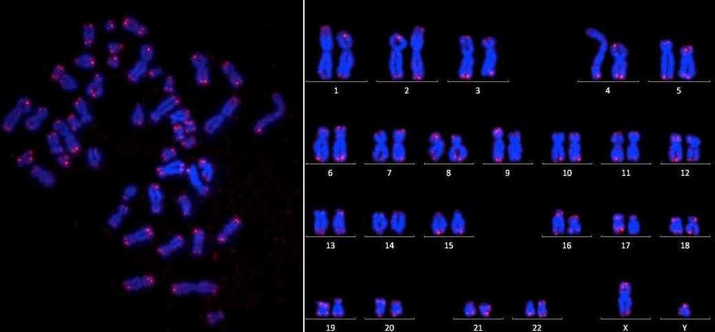 Изменение окраски хромосом. Хромосомы в микроскопе. Хромосомы человека микроскоп. Хромосомы под микроскопом. Хромосомы человека под микроскопом.